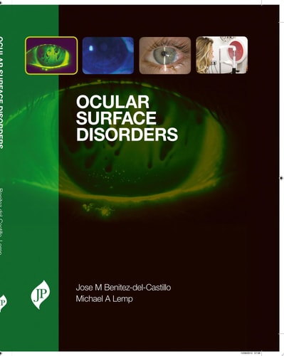 Ocular Surface Disorders-zoom-