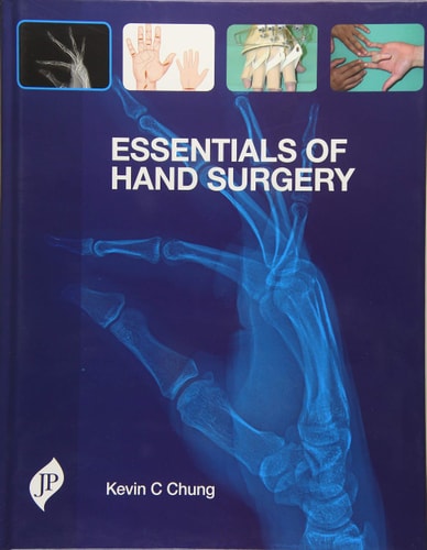 Essentials of Hand Surgery-zoom-