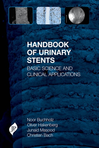 Handbook of Urinary Stents Basic Science and Clinical Applications-zoom-